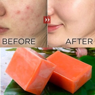 Vagina Straining und Detox Yoni Bleaching Soap Bar keine Medikamente 2 Jahre Haltbarkeit