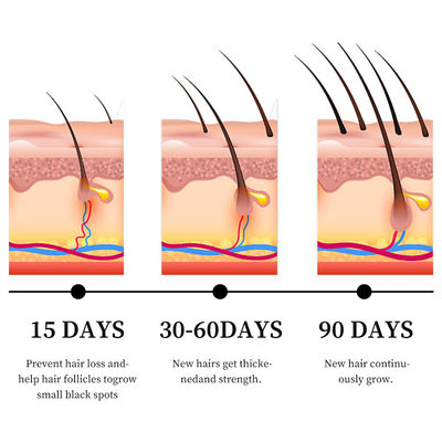 Wirksames Anti-Haarausfall-Serum mit Ingweröl und Vitamin B5